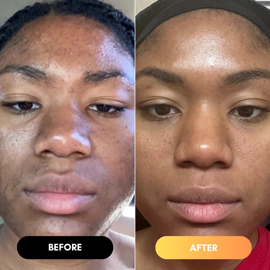 <h2>The AfroGlow Melanin Difference</h2>