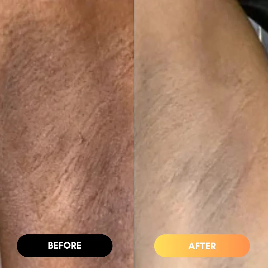 <h2>The AfroGlow Melanin Difference</h2>