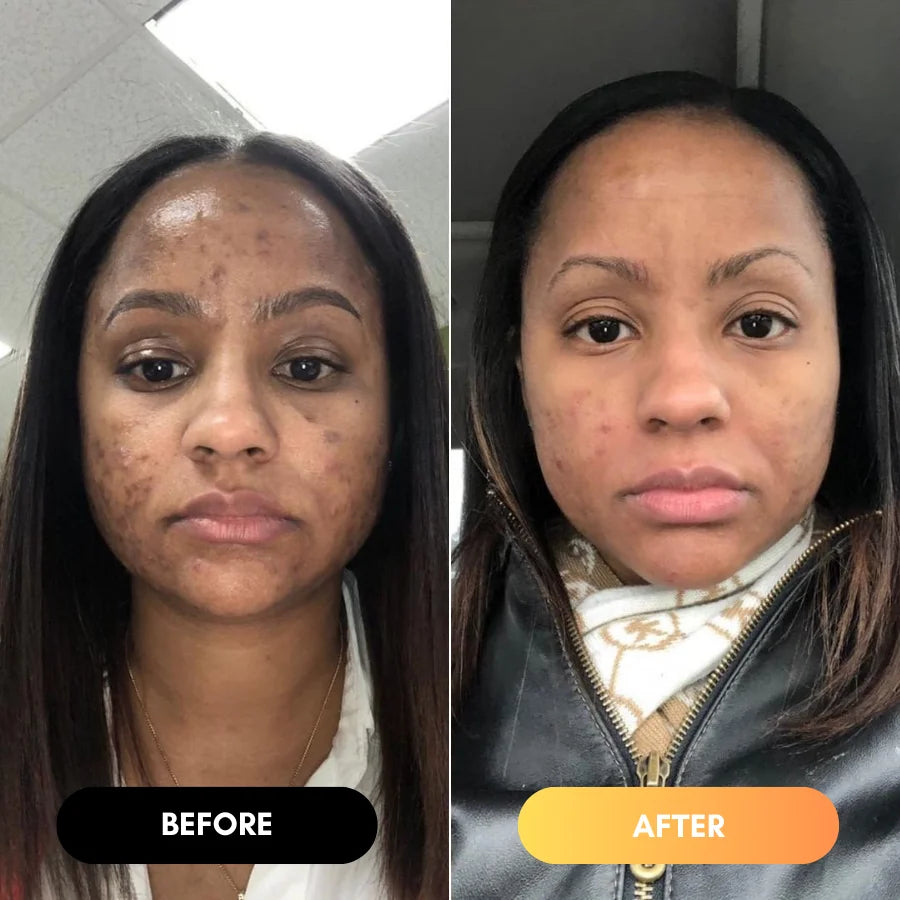 <h2>The AfroGlow Melanin Difference</h2>