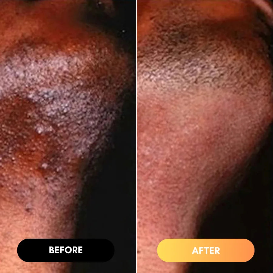 <h2>The AfroGlow Melanin Difference</h2>