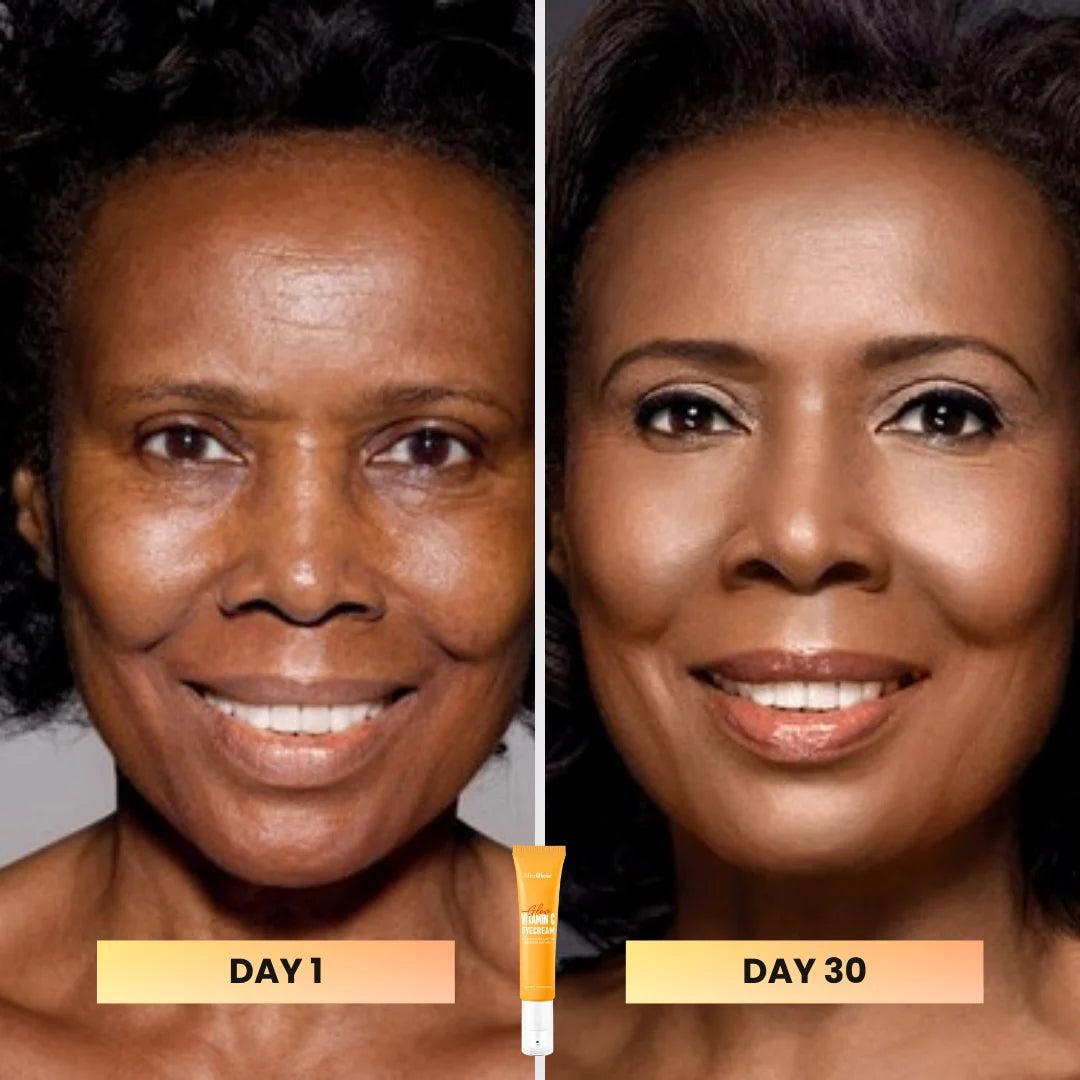 Vitamin C Eye Cream