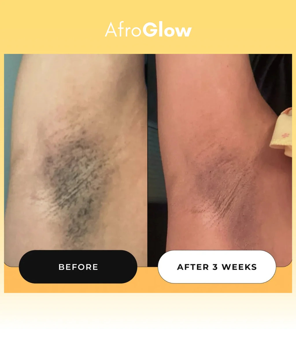 Turmeric Dark Spot Removal Scrub