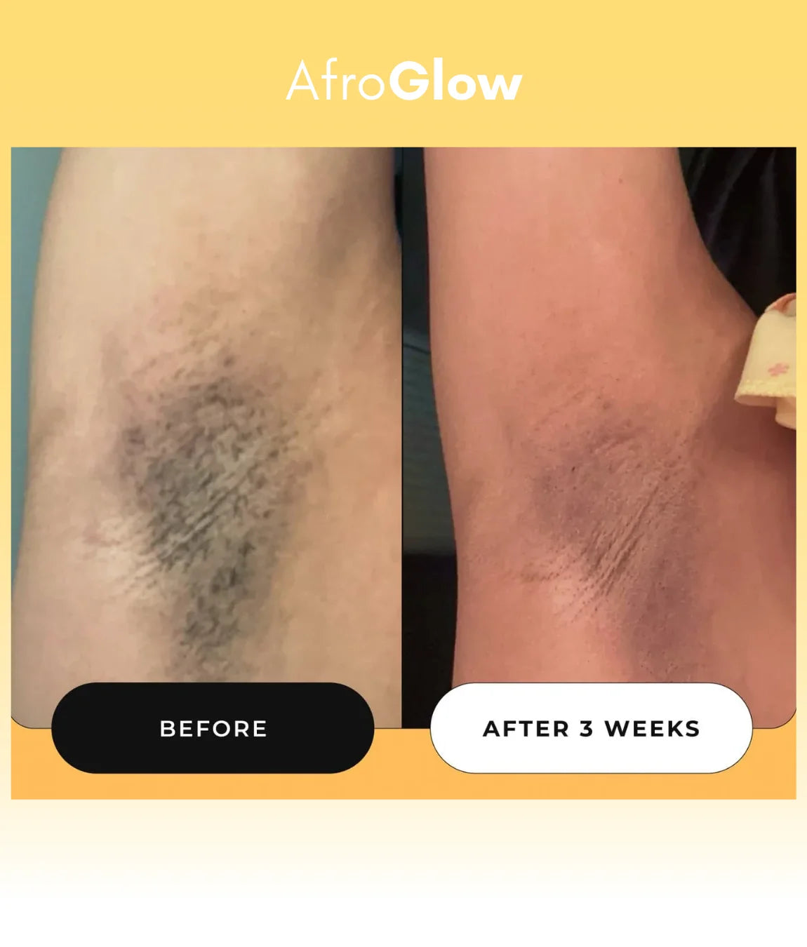 Turmeric Dark Spot Removal Scrub